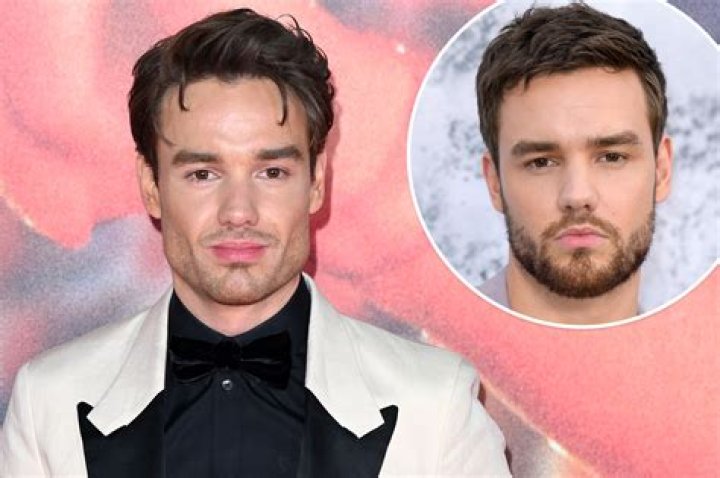 Liam Payne Nose Job: Before and After Transformation Revealed