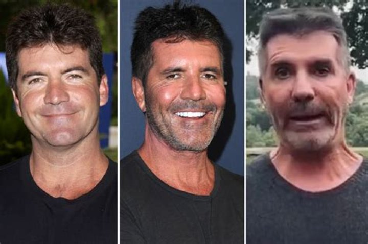 Simon Cowell's Son Illness 2024: A Look into the Challenges Ahead