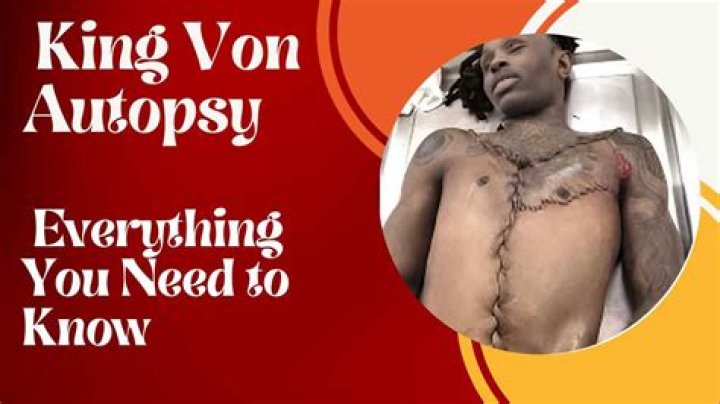 Understanding King Von's Autopsy Results: A Deep Dive into His Life and Legacy